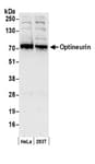 Detection of human Optineurin by western blot.