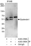 Detection of human Dysbindin1 by western blot of immunoprecipitates.