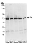 Detection of human and mouse FH by western blot.