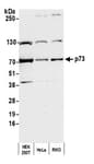 Detection of human p73 by western blot.