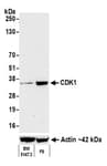 Detection of mouse CDK1 by western blot.