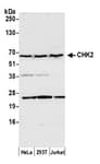 Detection of human CHK2 by western blot.