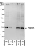 Detection of human and mouse PSMA5 by western blot.