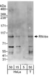 Detection of human RN-tre by western blot.