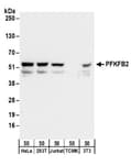 Detection of human and mouse PFKFB2 by western blot.