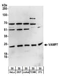 Detection of human and mouse VAMP7 by western blot.