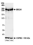 Detection of mouse BRCA1 by western blot.