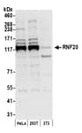 Detection of human and mouse RNF20 by western blot.