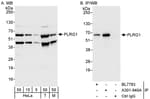 Detection of human and mouse PLRG1 by western blot (h&amp;m) and immunoprecipitation (h).