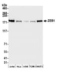 Detection of human and mouse ZEB1 by western blot.