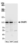 Detection of human CKAP2 by western blot.