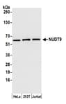 Detection of human NUDT9 by western blot.