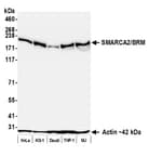 Detection of human SMARCA2/BRM by western blot.