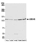 Detection of human and mouse UBE4B by western blot.