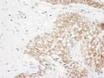 Detection of human Rictor by immunohistochemistry.