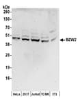 Detection of human and mouse BZW2 by western blot.