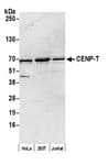 Detection of human CENP-T by western blot.