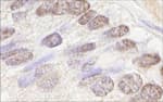 Detection of human ATM by immunohistochemistry.