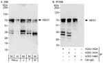 Detection of human and mouse AEG1 by western blot (h &amp; m) and immunoprecipitation (h).