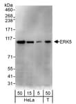 Detection of human ERK5 by western blot.