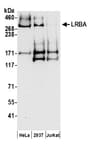Detection of human LRBA by western blot.