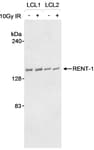 Detection of human RENT-1 by western blot.