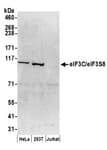 Detection of human eIF3C/eIF3S8 by western blot.