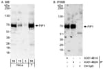 Detection of human FIP1 by western blot and immunoprecipitation.
