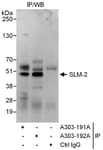 Detection of human SLM-2 by western blot of immunoprecipitates.