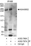 Detection of human KIAA0802 by western blot of immunoprecipitates.