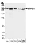 Detection of human NUP214 by western blot.