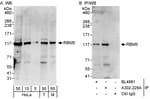 Detection of human and mouse RBM5 by western blot (h&amp;m) and immunoprecipitation (h).