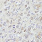 Detection of mouse PPM1G by immunohistochemistry.