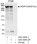 Detection of human AKAP13/AKAP-Lbc by western blot of immunoprecipitates.