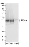 Detection of human ATG9A by western blot.