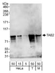 Detection of human and mouse TAB2 by western blot.