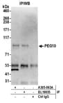 Detection of human PEG10 by western blot of immunoprecipitates.