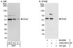 Detection of human Dcp2 by western blot and immunoprecipitation.