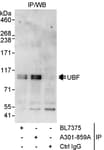 Detection of human UBF by western blot of immunoprecipitates.