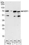 Detection of human NSP1 by western blot.