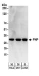 Detection of human PNP by western blot.