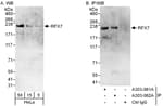 Detection of human RFX7 by western blot and immunoprecipitation.