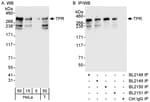 Detection of human TPR by western blot and immunoprecipitation.