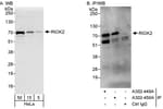 Detection of human RIOK2 by western blot and immunoprecipitation.