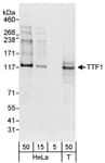 Detection of human TTF1 by western blot.