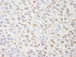 Detection of mouse TIF1 Alpha / TRIM24 by immunohistochemistry.