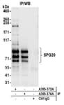 Detection of human SPG20 by western blot of immunoprecipitates.