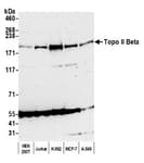 Detection of human Topo II Beta by western blot.