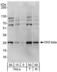 Detection of human and mouse CKII beta by western blot.