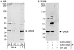 Detection of human ORC6 by western blot and immunoprecipitation.